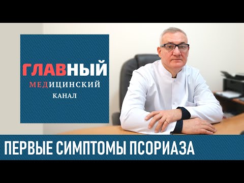 Признаки и симптомы псориаза. Как начинается и проявляется псориаз, начальная стадия