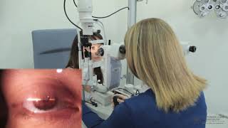 Slit Lamp Techniques   Smith's Method