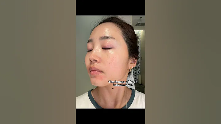 Lifesaver for damaged skin🫶