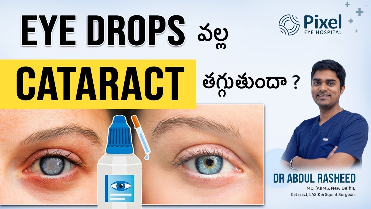 Eye Drops For Cataract Can Eye Drops Remove Cataracts Health Video Eye Drops For Cataract Can Eye Drops Remove Cataracts Health Video