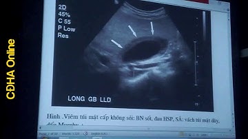 SIÊU ÂM CHẨN ĐOÁN BỤNG CẤP BS. NGUYỄN CAO CƯƠNG
