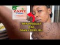 Zapit Cream: The Best Acne Solution You&#39;ve Never Tried&quot;