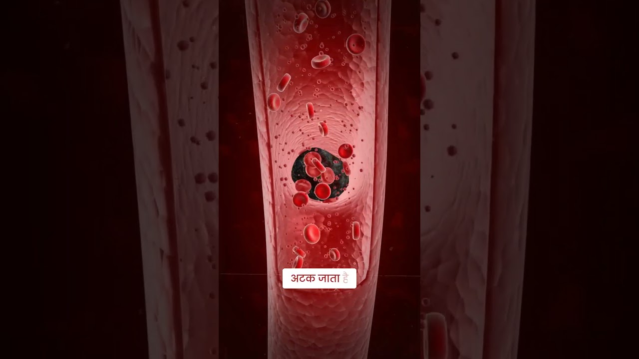 🚨 Heart Attack ≠ Cardiac Arrest!