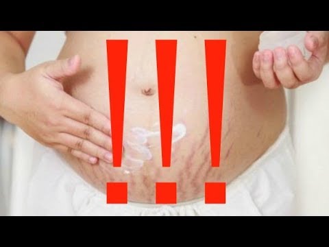 طرق سهلة للتخلص من ترهلات البطن بعد الولادة - ArabTub3