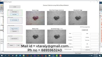 Disease Detection using Artificial Neural Network (MatLab)