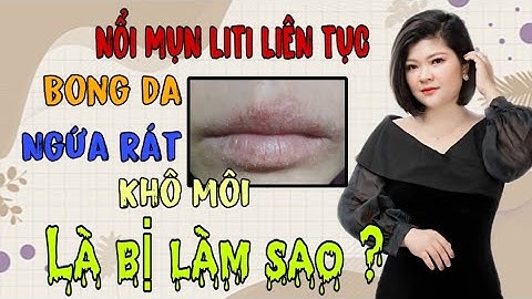 Mọc mụn nước ở môi là bị gì năm 2024