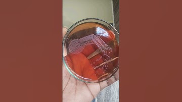 Bacterial colonies | culture media | bacterial growth on agar plates | how to grow bacteria #biology