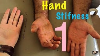 جلسة علاج طبيعي مع تقييم لتيبس اليد و الرسغ 🙌🏽 ج1 PT session for wrist stifness post fracture