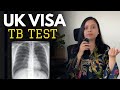 TB Test For UK Visa Complete Process