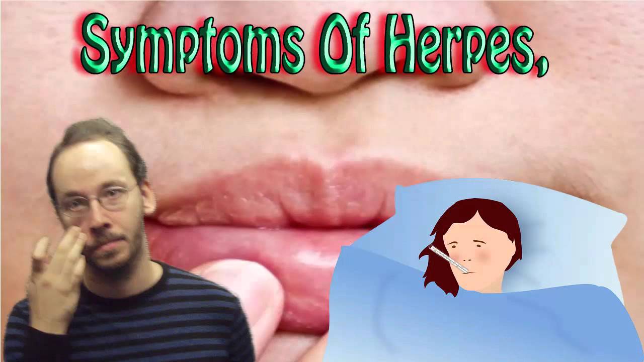 Natural Cure For Herpes Genital Or Oral Herpes Best Natural Cure