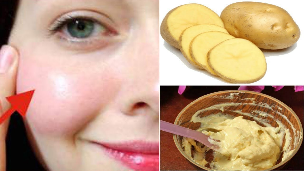 1 ही दिन में चेहरे को इतना गोरा बना देगा ये नुस्खा / Get Fair, Spotless & Glowing Skin Permanently - YouTube