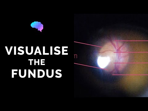 Video: Er tigroid fundus normal?