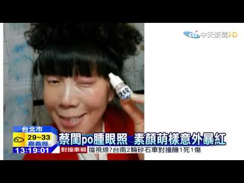 20150509中天新聞　蔡閨po腫眼照　素顏萌樣意外爆紅