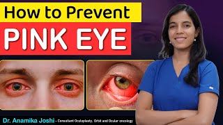 How to prevent pink eye | How to prevent conjunctivitis eye | Dr Anamika Joshi