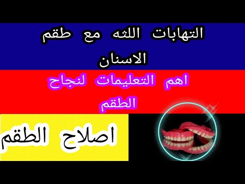 تعليمات بعد تركيبات الاسنان المتحركه🔉 (التهابات-الاكل علي الطقم - تنظيف طقم الاسنان-الطقم هيتكسر؟)