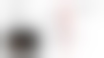 Case study - Reflux in GSV with varicosity