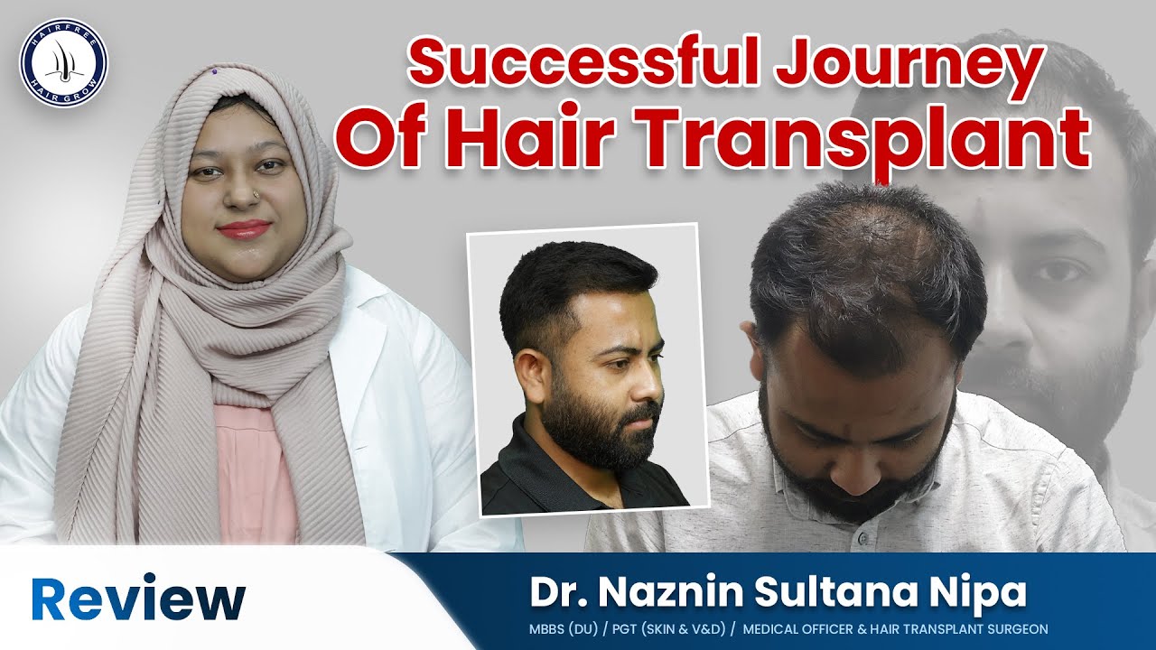 Hair Transplant in Bangladesh : Hair Transplant Success Story From Dhaka