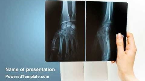 X-Ray Photography PowerPoint Template by PoweredTemplate.com