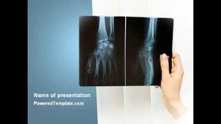 X-Ray Photography PowerPoint Template by PoweredTemplate.com