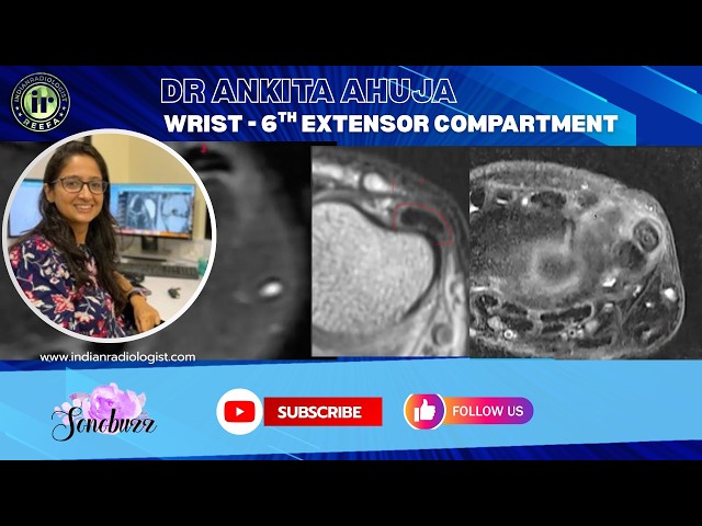 Thumbnail for DR ANKITA AHUJA | 6TH EXTENSOR COMPARTMENT #mriteachingcourse