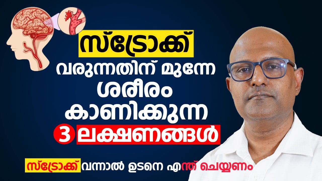 സ്ട്രോക്ക് ഈ 3 ലക്ഷണങ്ങൾ ഒരിക്കലും നിസാരമാക്കരുത് | Stroke വന്നാൽ ഉടനെ എന്ത് ചെയ്യണം Dr. Boby Varkey