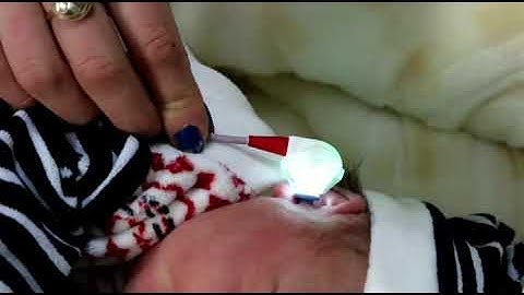 DPOAE Screening on the SENTIERO