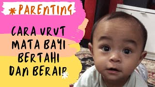 Penyakit Mata Bayi Ibu Bapa Tidak Boleh Ambil Mudah Hello Doktor