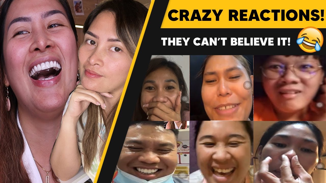 My Friend's Reaction To Seeing My New Nose For The First Time! 👃😂 | Day ...