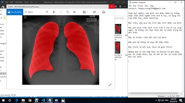 Segmentation of Lungs from Chest X-Ray