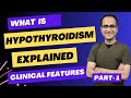 Hypothyroidism symptoms medicine lecture clinical signs and symptoms presentation usmleneetpg