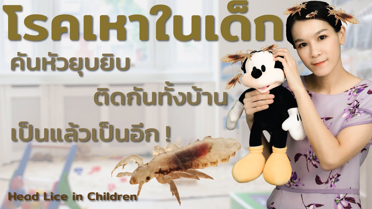 โรคเหาในเด็ก Head Lice in Children