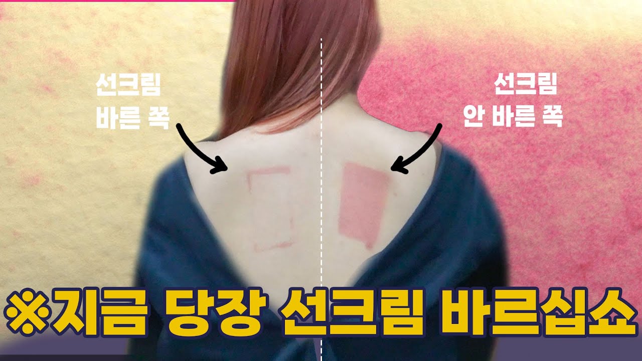 당신이 선크림을 꼭 발라야하는 이유.. 피부가 바로 까맣게 타버림😱😱