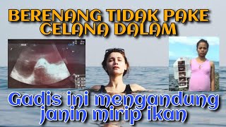Geger Tak Pakai Cd Berenang Di Laut, Gadis Ini Langsung Hamil, Janin Yang Dikandungnya Mirip Ikan