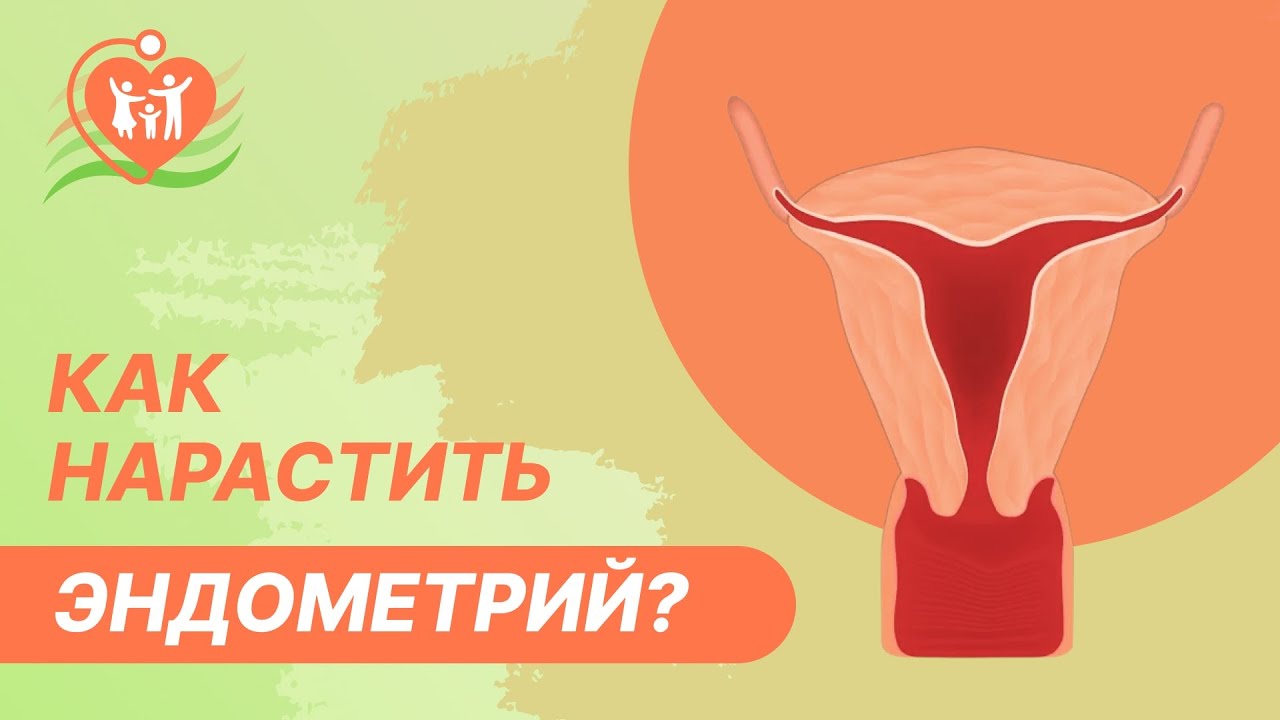 📝 Тонкий эндометрий. Как нарастить эндометрий? - YouTube