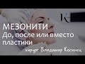 Мезонити. До, после или вместо пластики. Хирург Владимир Косинец