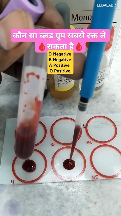 Blood Which Blood Group Is blood-which-blood-group-is