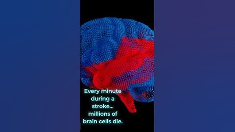 The AI That Could Save Your Brain in 60 Minutes | #aitools #aiinmedicine #chatgpt #openai #ytshorts