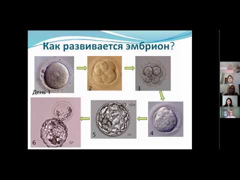 Качество эмбрионов. Выбор оптимального эмбриона для переноса