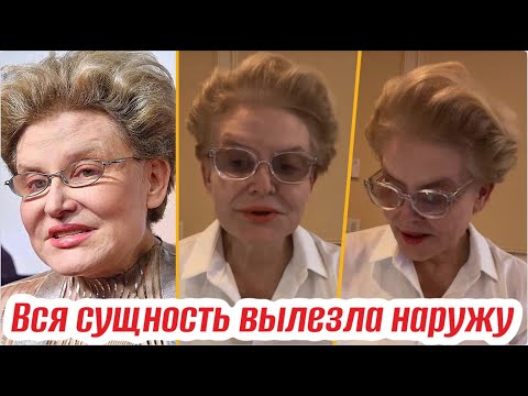 Брови вверх, на губах улыбка Джокера. Малышева показала себя после неудачной пластики