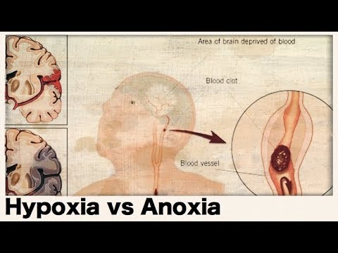 What is the difference between hypoxia and anoxia?