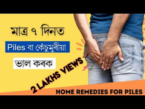 Piles বা কেঁচুমুৰীয়া ৰ ক্ষেত্ৰত সকলোতকৈ উপযোগী ঘৰুৱা চিকিৎসা  || Treatment for Piles