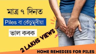 Piles বা কেঁচুমুৰীয়া ৰ ক্ষেত্ৰত সকলোতকৈ উপযোগী ঘৰুৱা চিকিৎসা  || Treatment for Piles screenshot 1