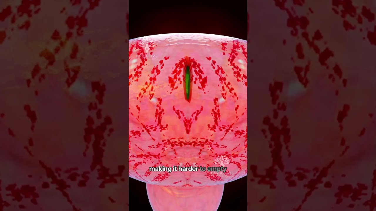 What Happens When You Hold Pee For Too Long Short Urineinfection Creativelearning3d