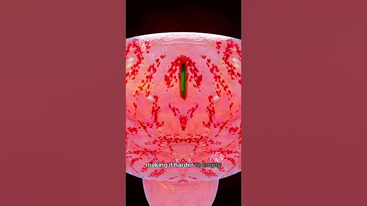 What Happens When You Hold Pee for Too Long 😱 #short #urineinfection - Creativelearning3d