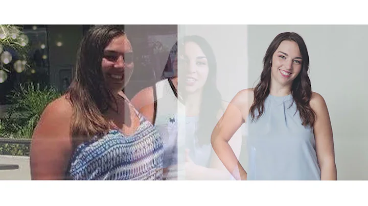 New York Bariatric Group - Caitlyn Stegman - Patie...