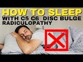 Ep19 How To Sleep With C5 C6 Disc Bulge Radiculopathy | Dr. Walter Salubro Chiropractor in Vaughan