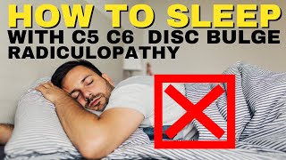 Ep19 How To Sleep With C5 C6 Disc Bulge Radiculopathy | Dr. Walter Salubro Chiropractor in Vaughan screenshot 1