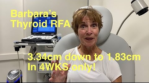 Thyroid RFA patient interview with Sean Nikravan, MD