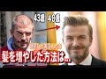 【薄毛バレない髪型】実はハゲていた有名人トップ７【薄毛対策】