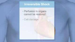 What is Shock